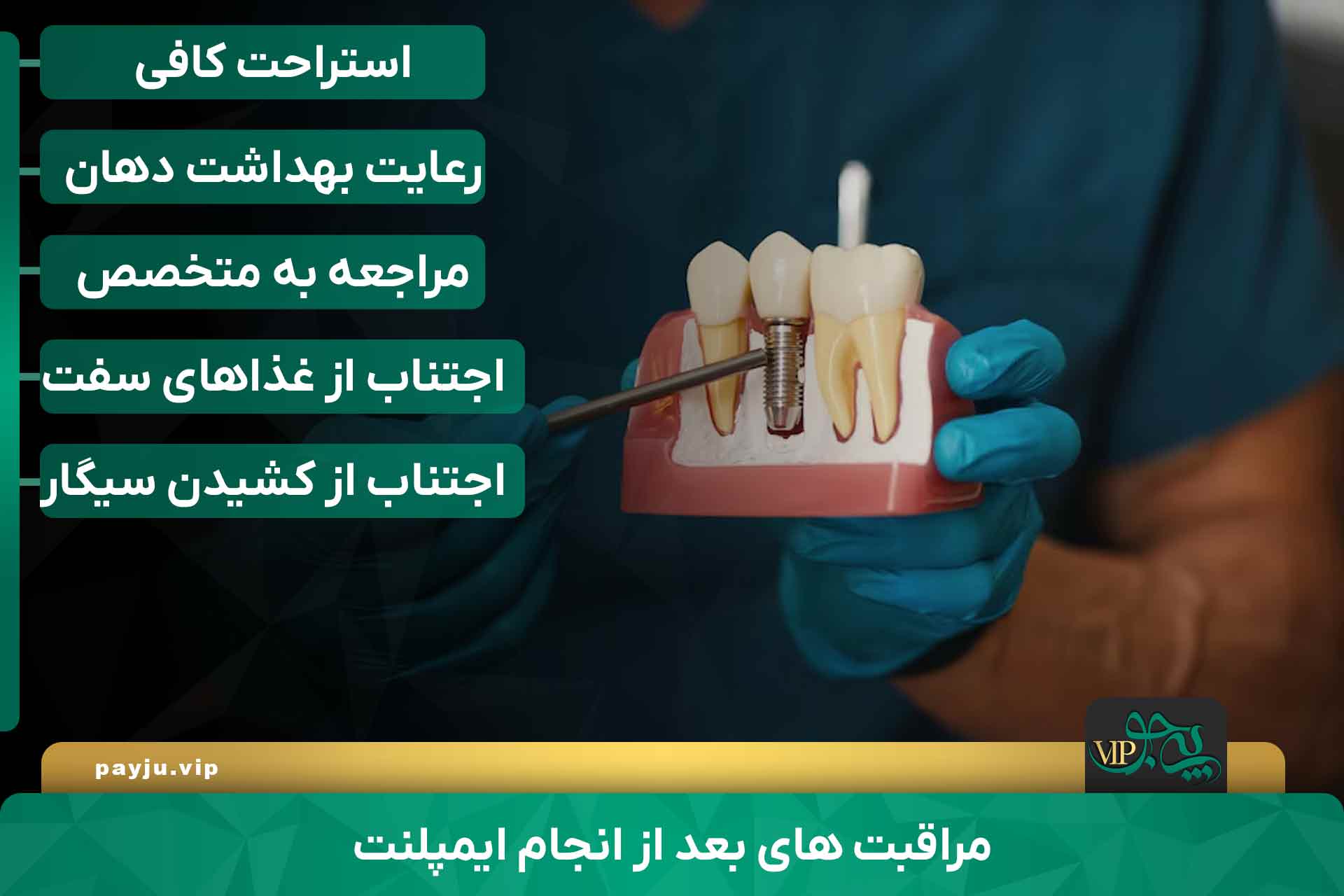 متخصص ایمپلنت دندان در شیراز