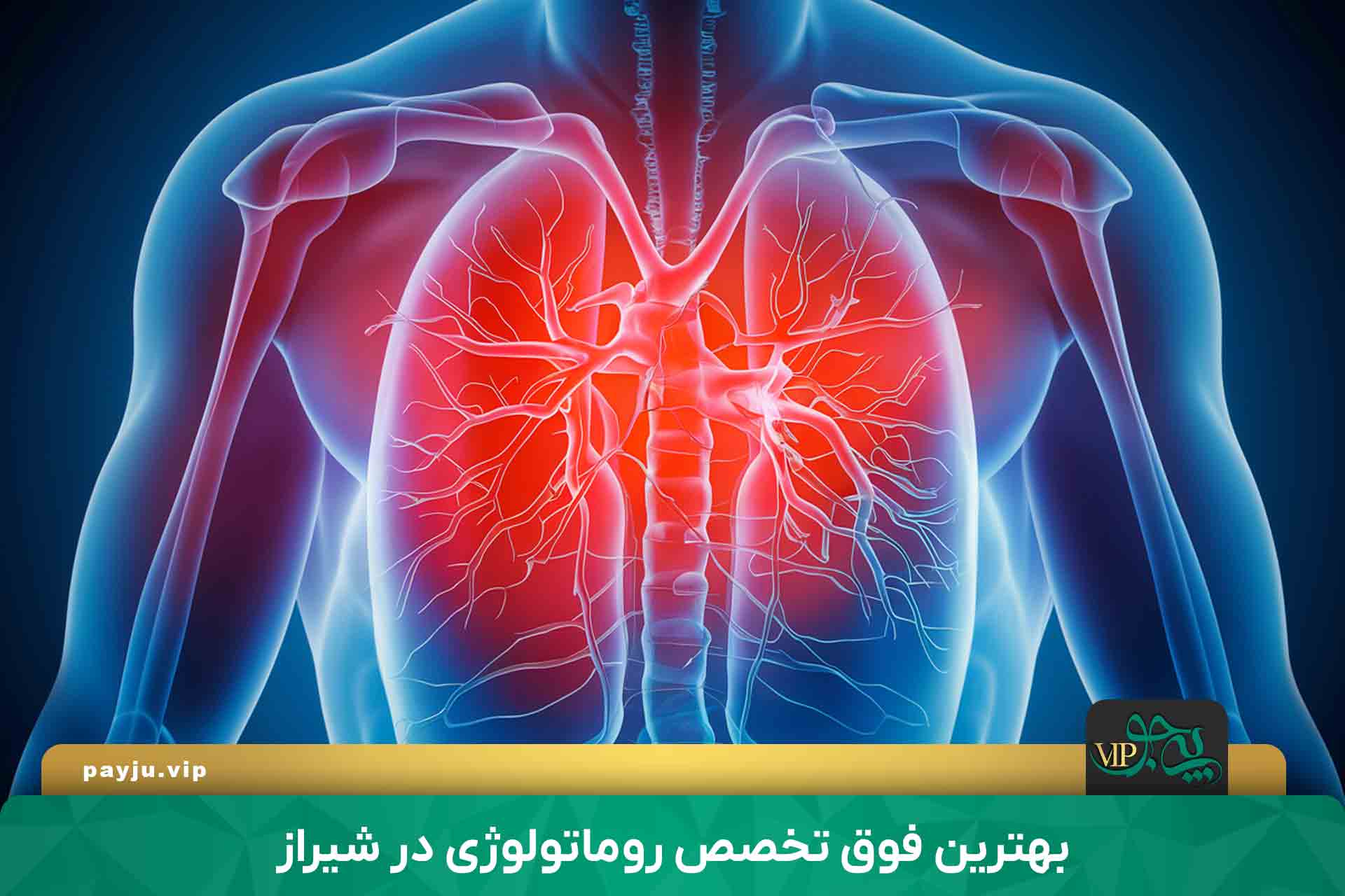 فوق تخصص روماتولوژی در شیراز