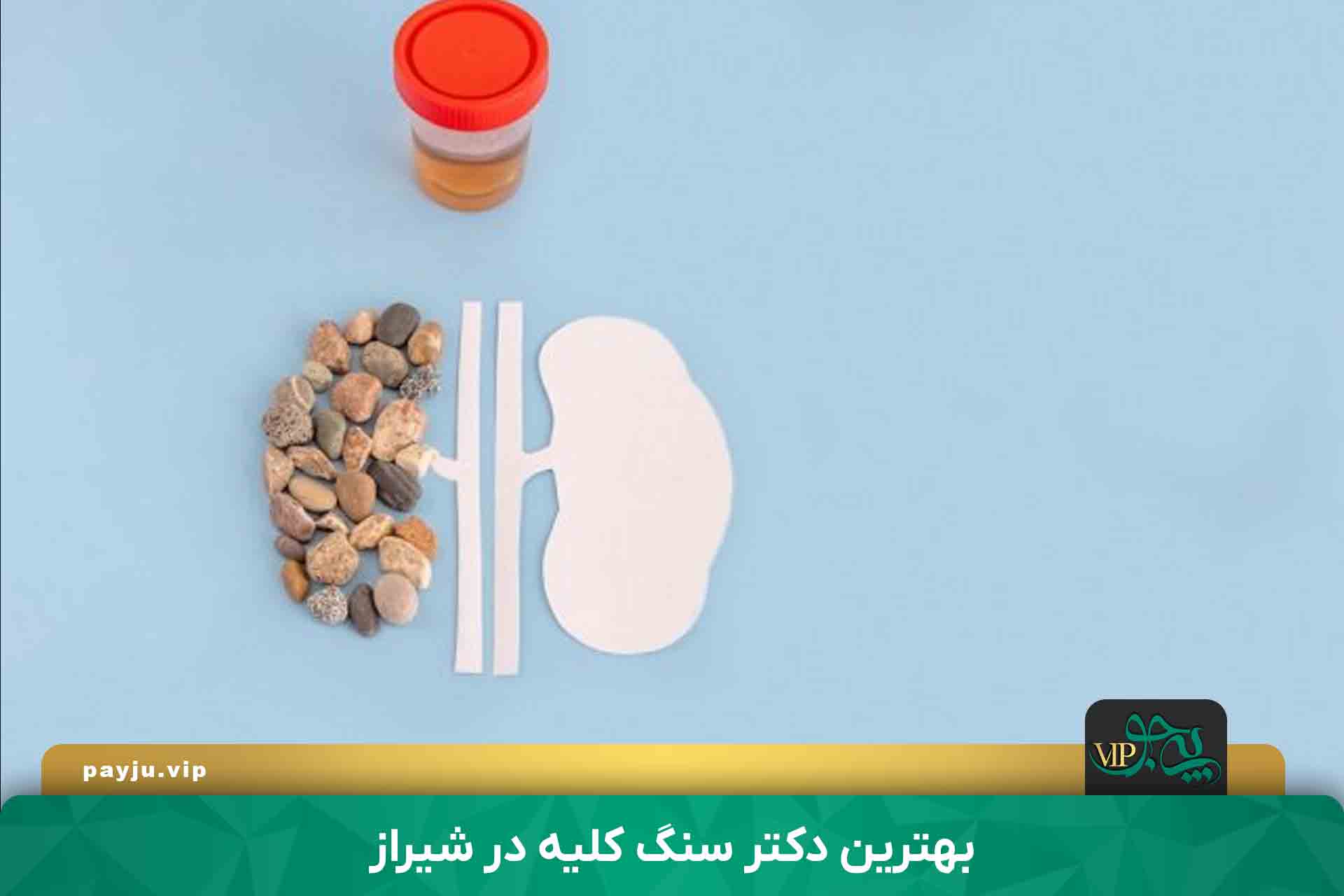 بهترین دکترهای درمان سنگ کلیه در شیراز