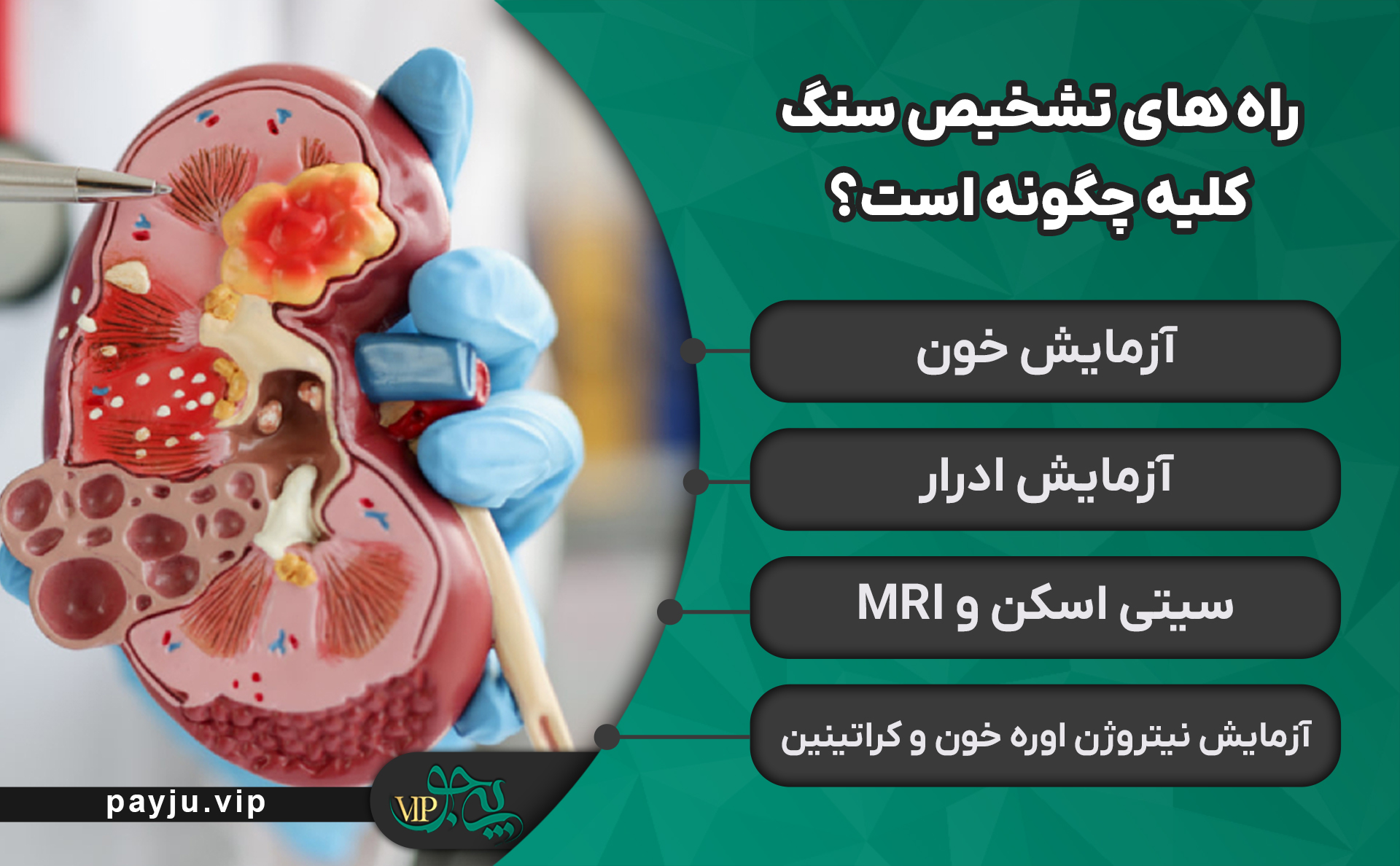 بهترین دکترهای درمان سنگ کلیه در شیراز