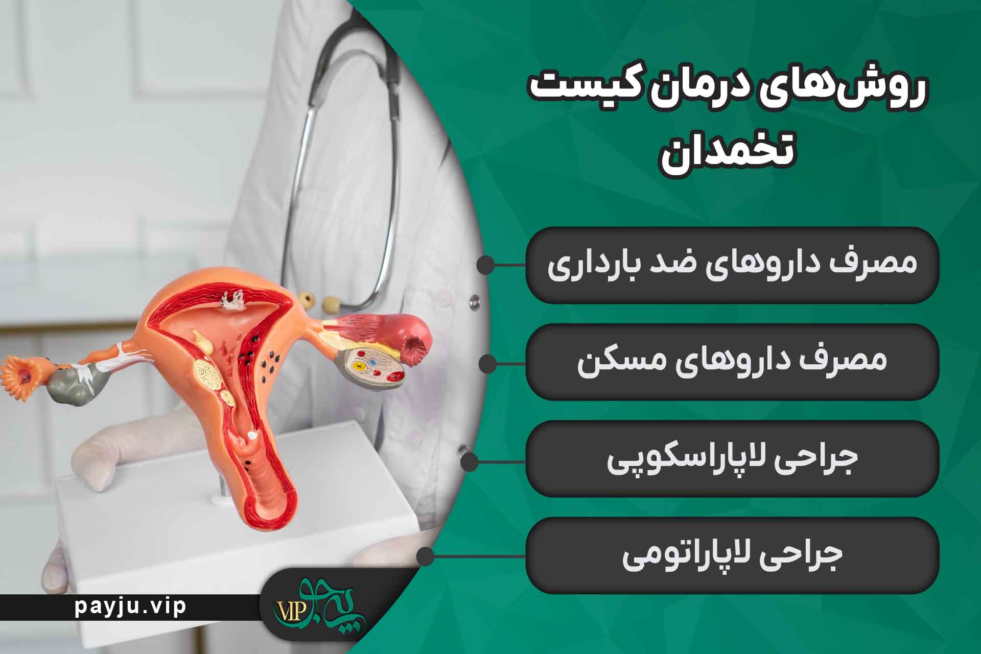 بهترین دکتر کیست تخمدان در شیراز